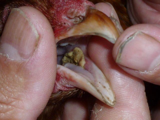 Oral Canker – after treatment